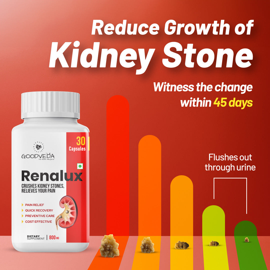 Renalux #1 ayurvedic formula for a stone free life, Naturally Best results in 45 days.
