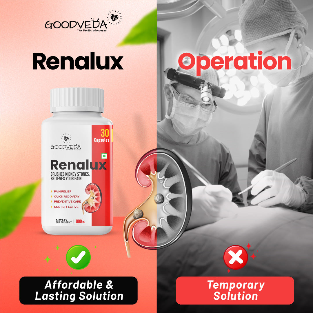 Renalux #1 ayurvedic formula for a stone free life, Naturally Best results in 45 days.