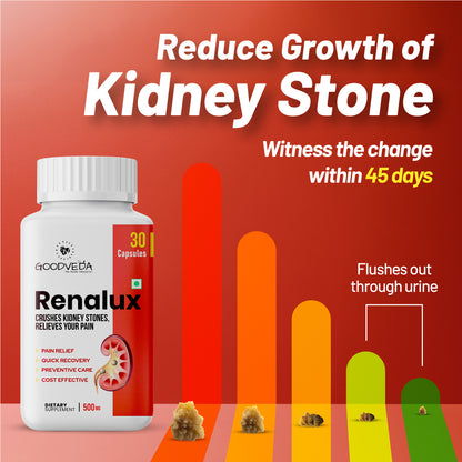 Renalux #1 ayurvedic formula for a stone free life, Naturally Best results in 45 days.