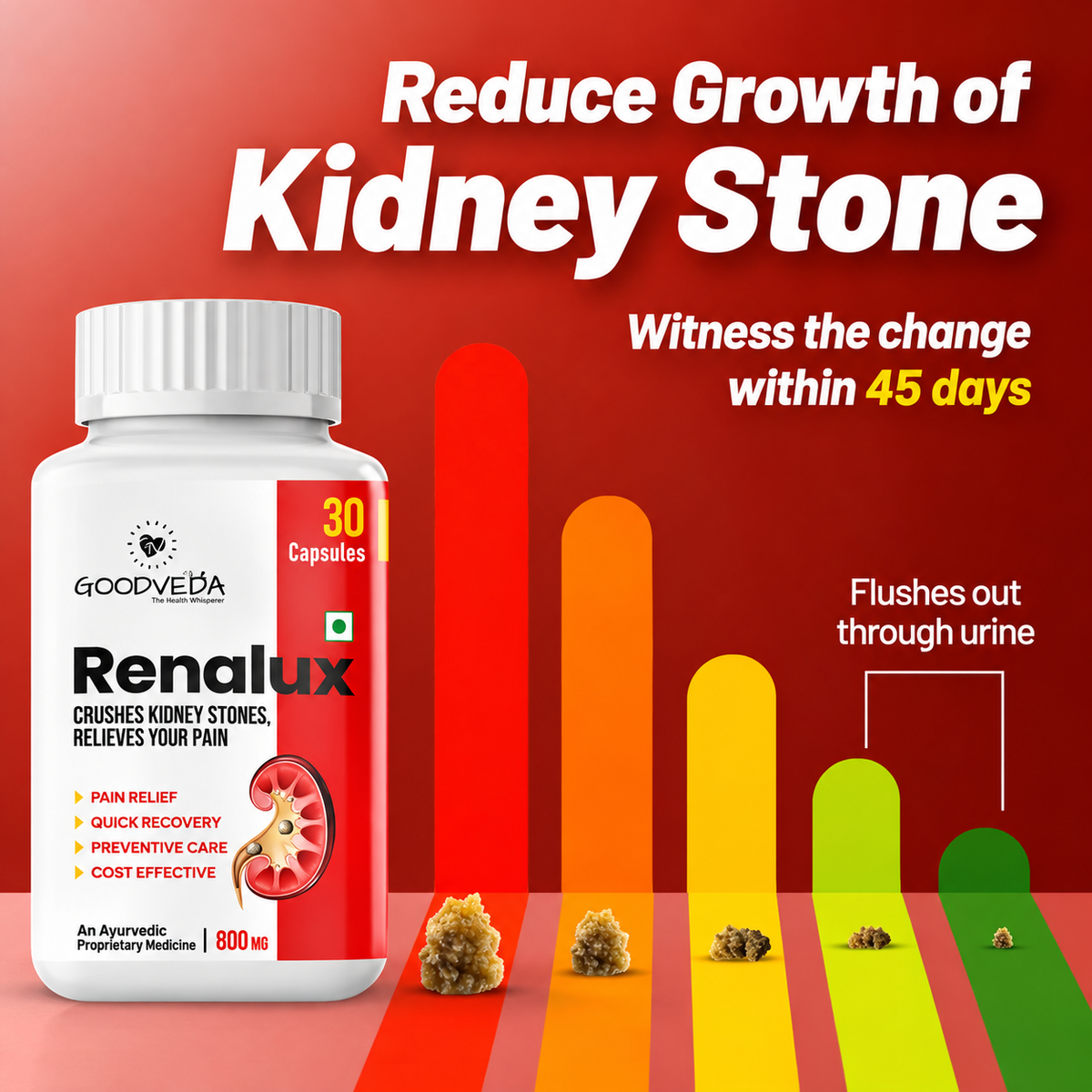 Renalux #1 ayurvedic formula for a stone free life, Naturally Best results in 45 days.